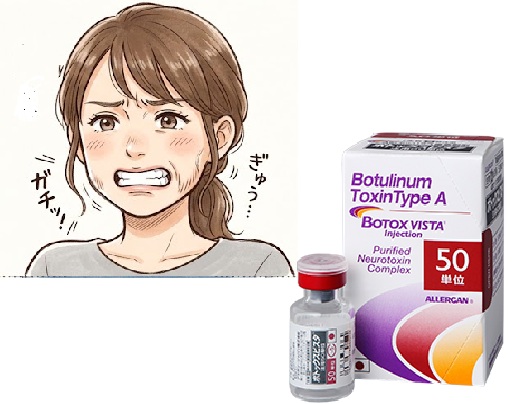 歯ぎしり・食いしばり・エラの張り（咬筋ボトックス）