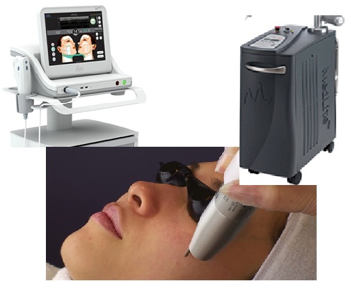 たるみ・リフトアップ（医療用HIFU・ウルセラ）