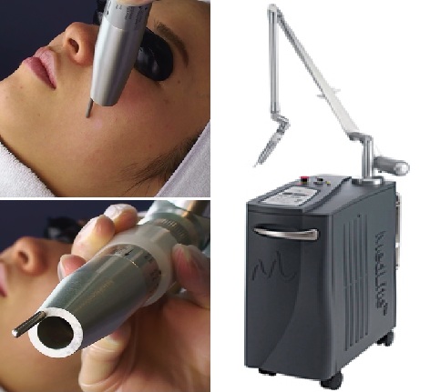 しみ・そばかす・肝斑（レーザー治療）